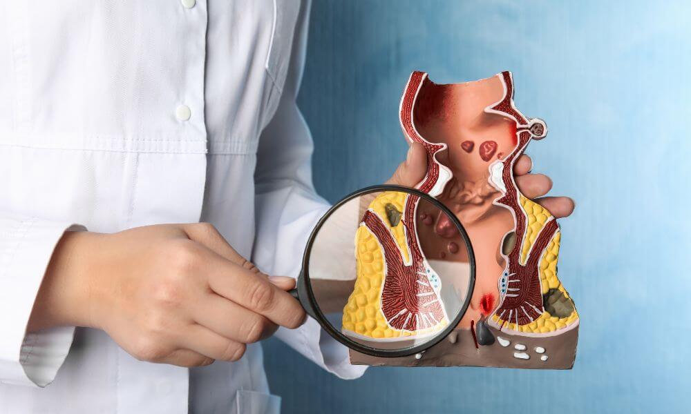 A person in a lab coat is holding a detailed anatomical model of the human intestines, examining it with a magnifying glass.