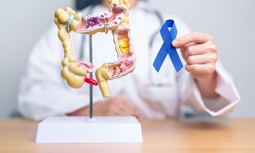 early detection and prevention of colorectal cancer