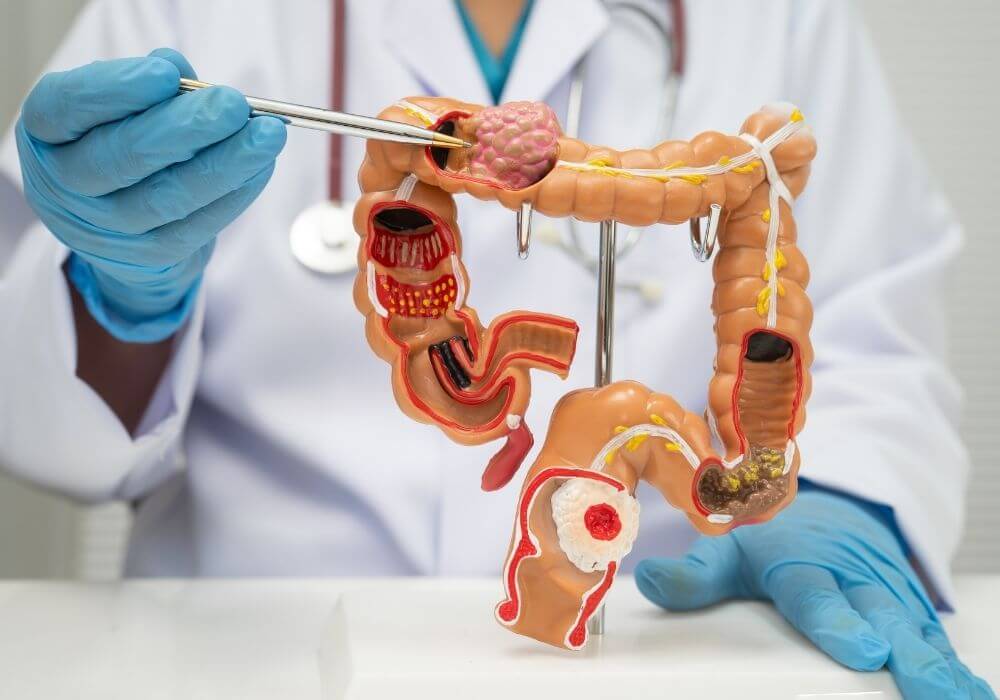 Robotic Surgery for Colorectal Conditions